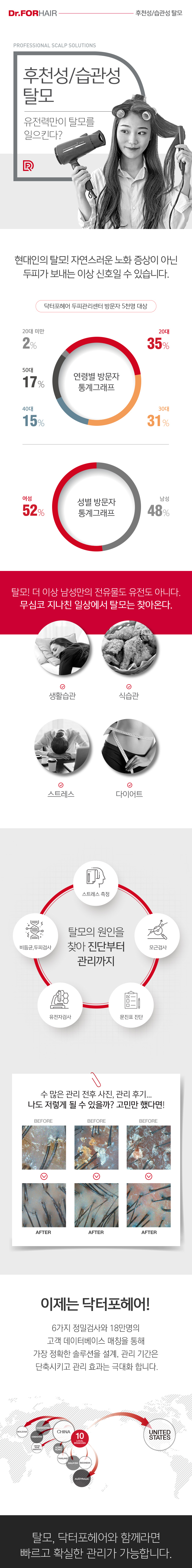 후천적습관성탈모